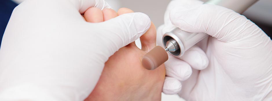 Close-up of a foot receiving a medical pedicure treatment